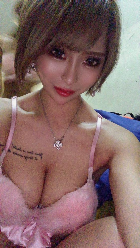 キャバ嬢しててやってよかった整形とは？