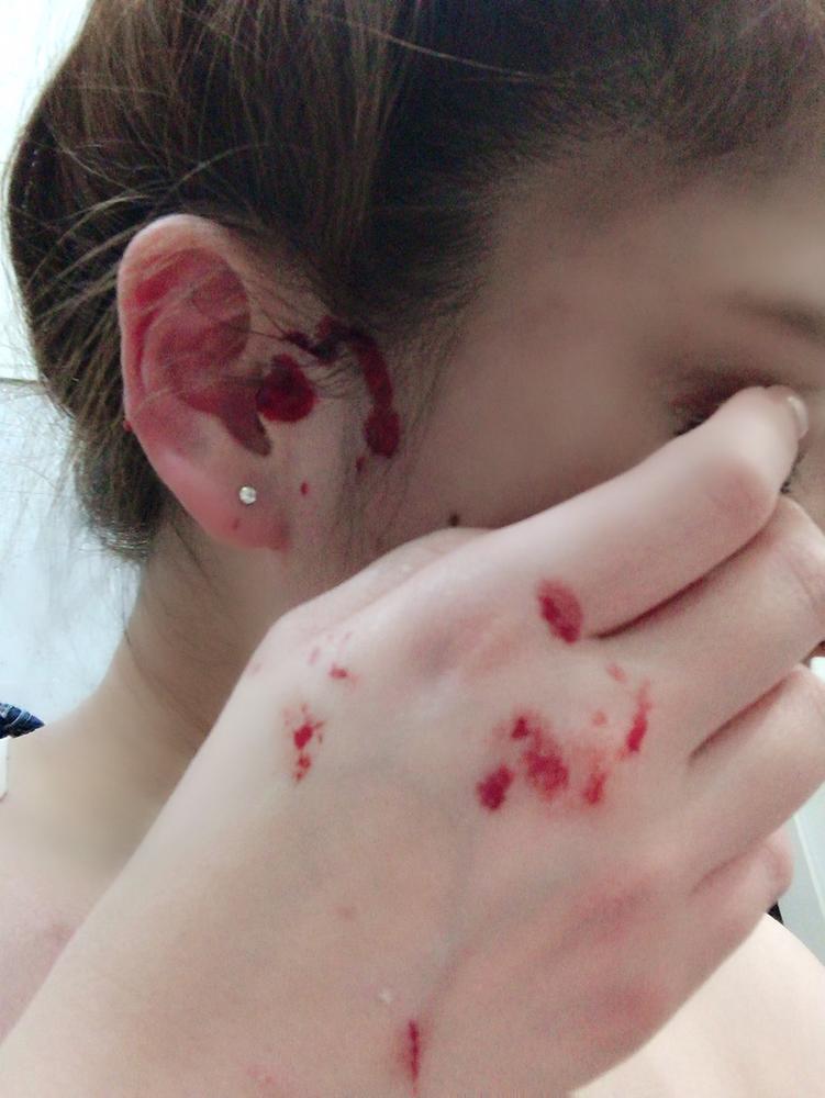 出血大サービス