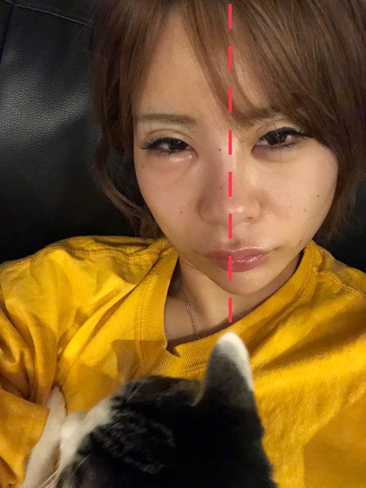 人には言えない整形の失敗談