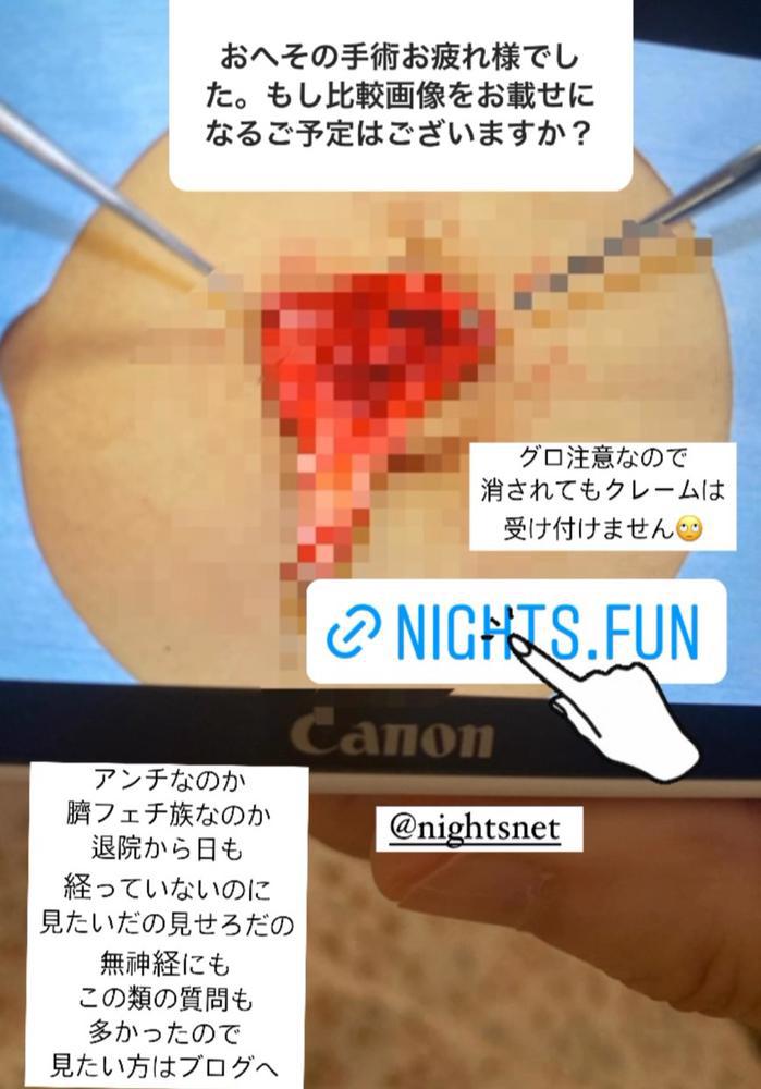 グロ注意(注意)手術写真公開