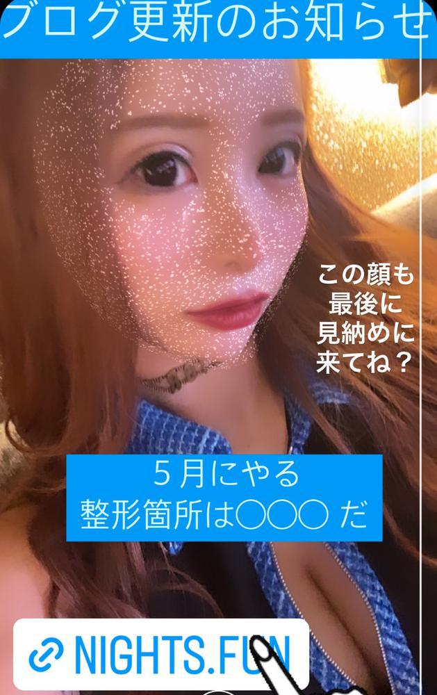 5月の整形箇所は◯◯◯