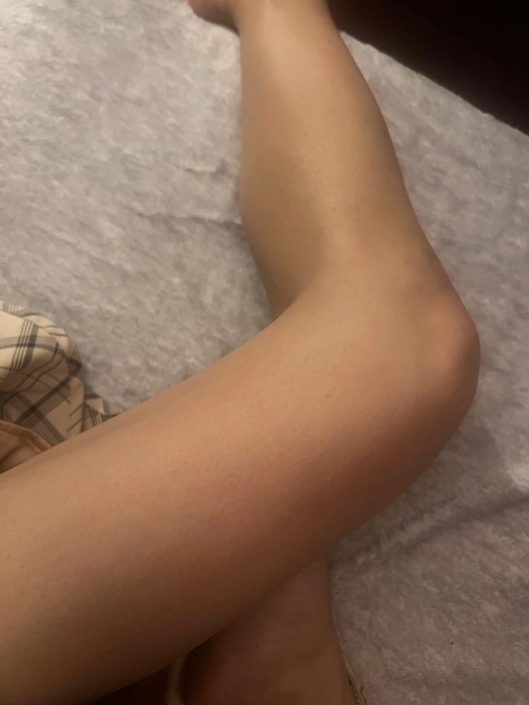 実は◯◯アレルギーです