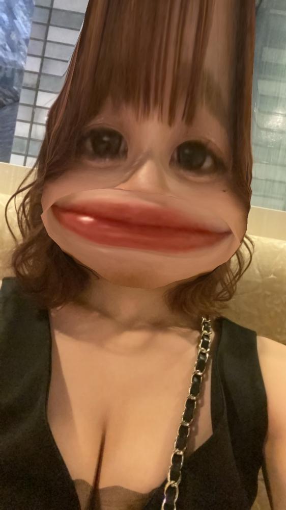 膝のあざの正体🦵