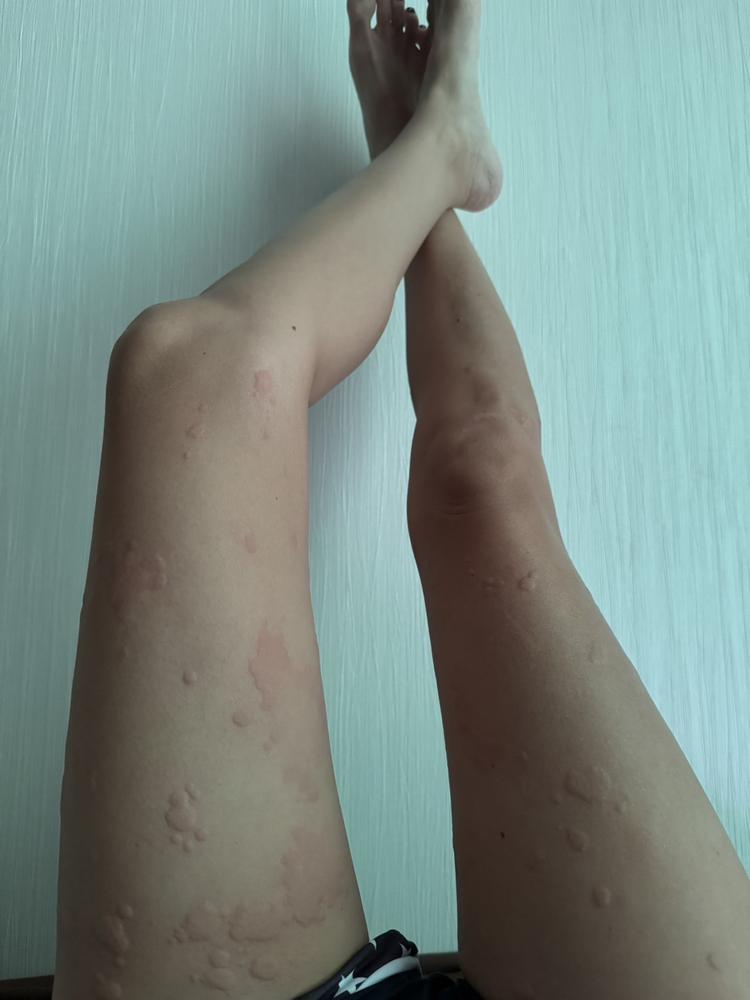 皆んなも疲れには気をつけて