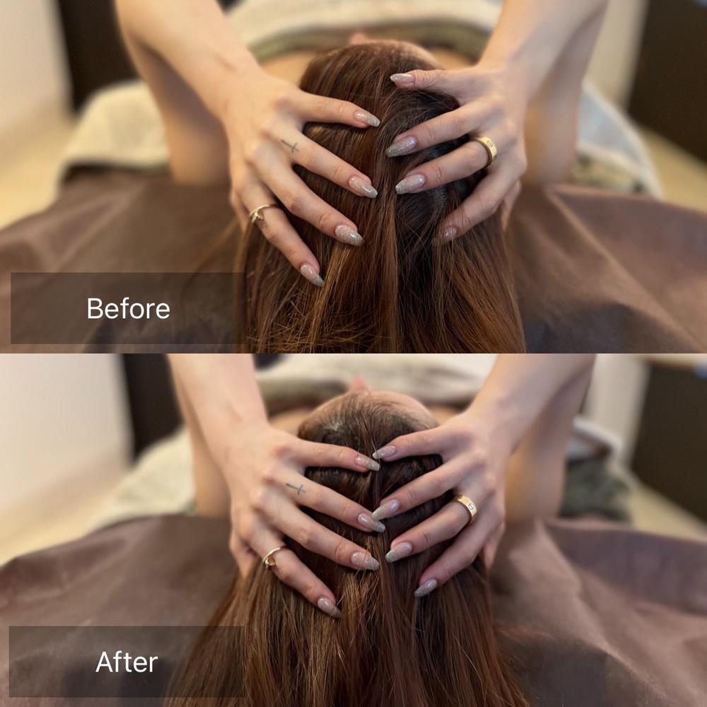 頭蓋骨小顔矯正のまさかの効果