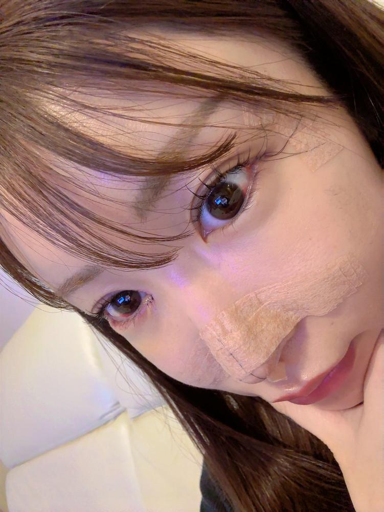 だいぶ良くなりました😊