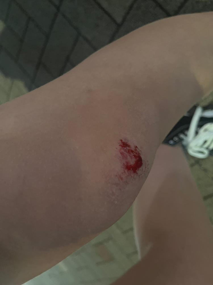 転けた🙂‍↕️