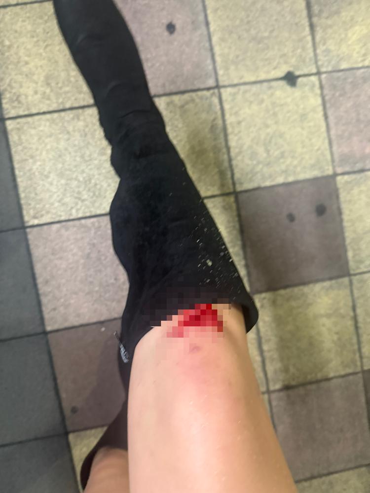 自転車ひかれた😿