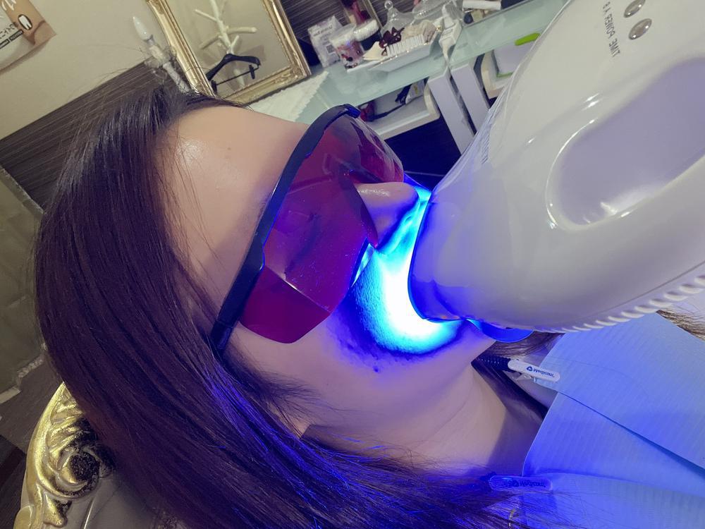 ホワイトニング