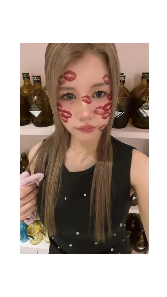 浮腫浮腫むくみ