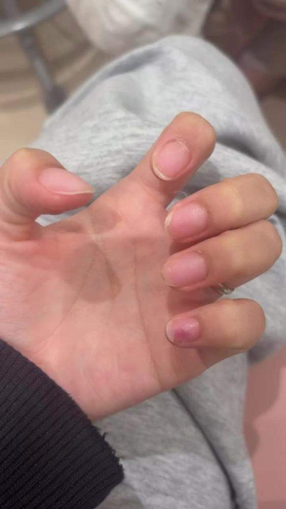 除去💅